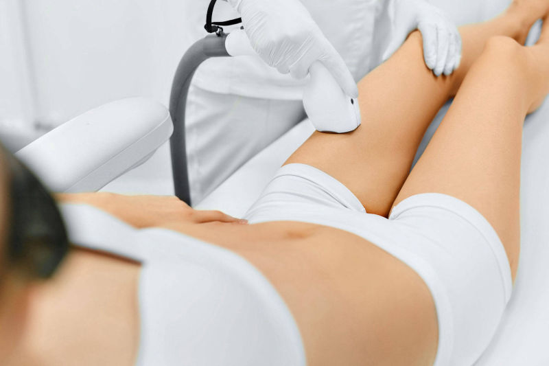 Depilazione Laser Gambe Donna - Piazza Dante Livio Bianco