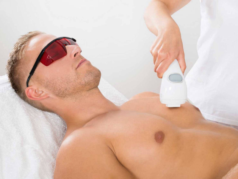 Depilazione Laser Petto Uomo o Laser Barba